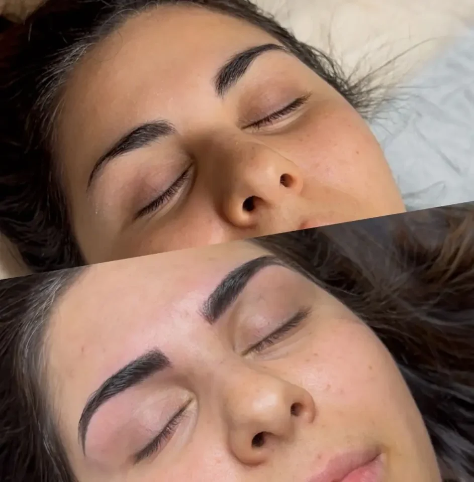 before and after microblade