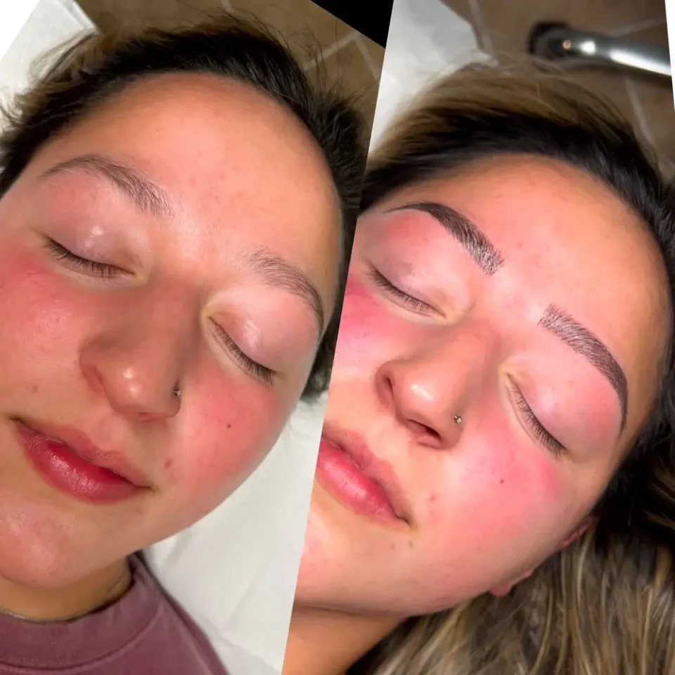 before and after microblade