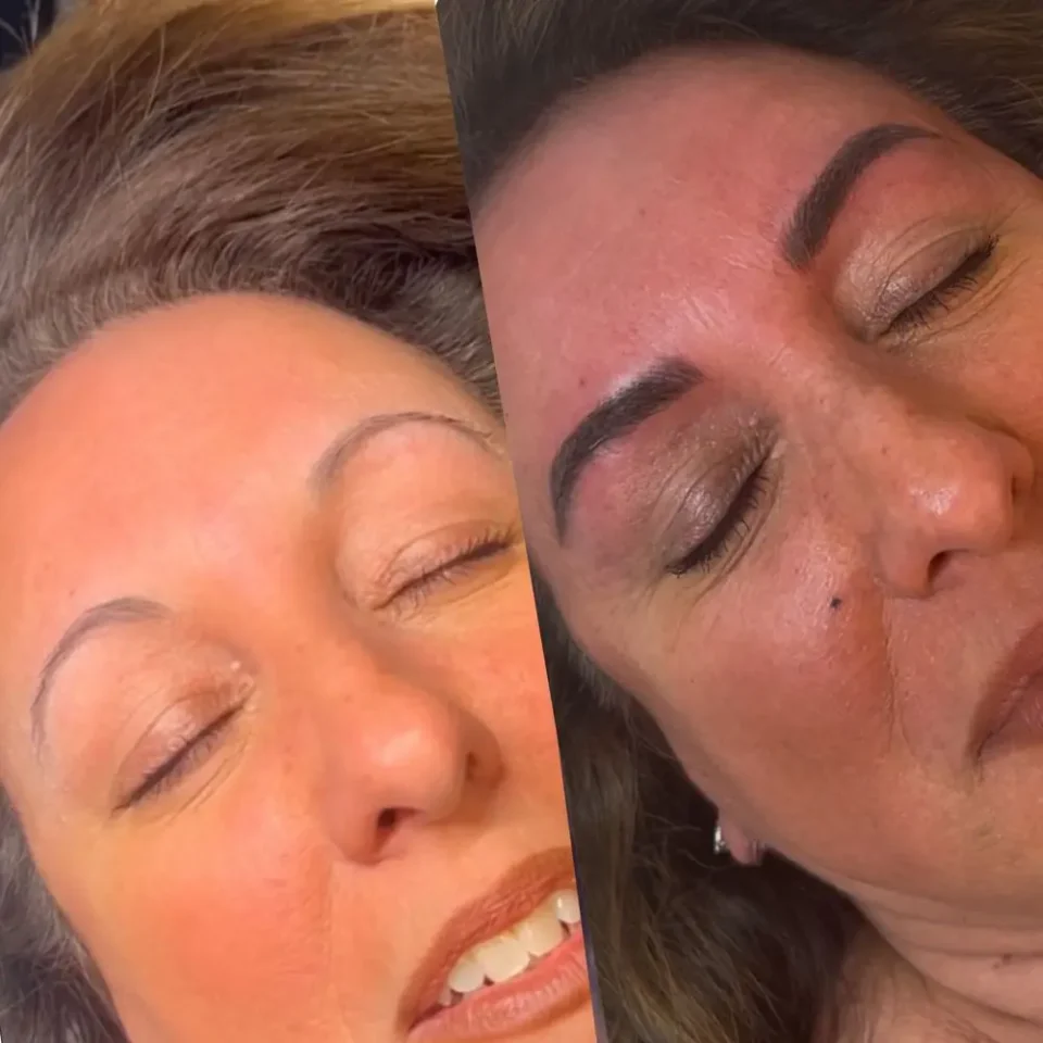 before and after microblade