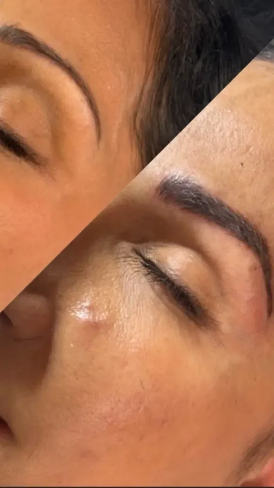 before and after microblade